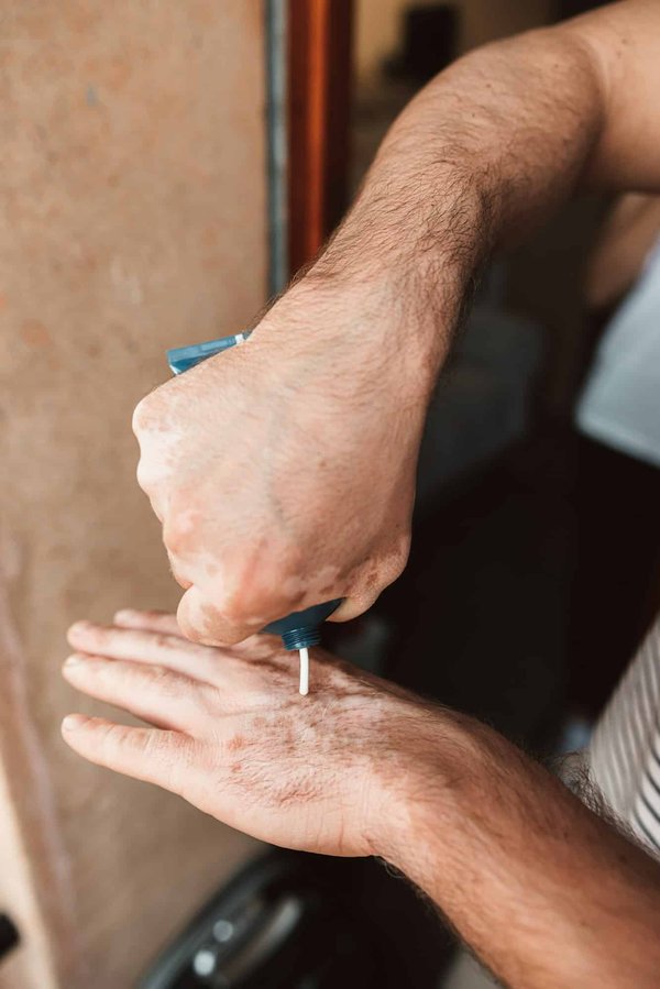 Comment gérer les effets secondaires des traitements anticancéreux sur la peau?
